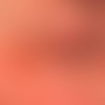 Demodex-Follikulitis: Bild der "periokulären Dermatitis". Keine vorbekannte Behandlung mit Lokalk...
