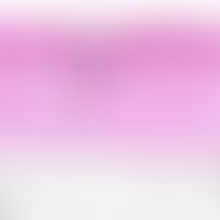 Dermatitis, perifolliculitis, peri- and infundibular (example: keratosis follicularis; lichen pla...