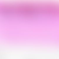 Superficial, perivasculardermatitis, psoriasiform (example: pityriasis rubra pilaris; allergic co...