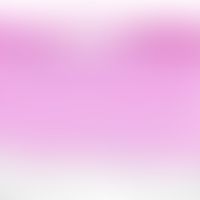 Dermatitis: Superficial, perivascular and/or interstitial dermatitis, with subepidermal blisterin...