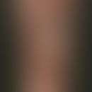 Metastase. Multiple, unterschiedlich große, z.T. rötliche, z.T. dunkel pigmentierte glatte Knoten...