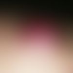Metastasis: Chronically active, rapidly growing, hemispherically protruding, well-defined to the ...