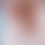 Reticulohistiocytosis(s): Disseminated to lenticular, reddish-brownish papules in the armpit area...