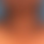 Acanthosis nigricans benigna bei bekanntem Diabetes mellitus
