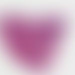 Acrodermatitis chronica atrophicans. inflammatory oedematous stage: irregular acanthotic epitheli...
