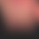 Acrodermatitis continua suppurativa:&nbsp;ausgeprägte steril-pustulöse, akrale Dermatitis mit&nbs...