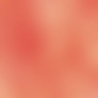 Erythrosis interfollicularis colli. reflected light microscopy: cervical region in a 53-year-old ...