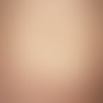 Exanthema subitum. 2-year-old boy with a severe disturbance of the AZ and an acute high fever of ...