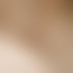 Fasciitis nodularis pseudosarcomatosa, a subcutaneous, coarse, centrally reddish translucent node...