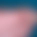 Fibromatosis, digital infantile. detailed enlargement of the findings of the right big toe of the...