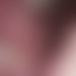 Fibromatosis gingivae (idiopathica): Sharply defined, soft, not pressure-painful, pink, smooth lu...