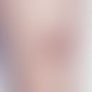 Fibrosarcoma: Fast growing, existing for 6 months, very coarse, about 5.0 cm in diameter, large, ...
