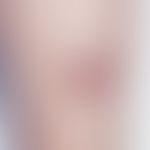 Fibrosarcoma: Fast growing, existing for 6 months, very coarse, about 5.0 cm in diameter, large, ...