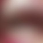 Fibrose, orale submuköse. Chronisch-entzündliche, langsam progrediente Erosionen, Epithelatrophie...