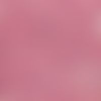 Fibroxanthom, atypisches. Detailvergrößerung: Erhebliche Zellpolymophie, spindelige Zellen, mehrk...