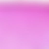 Fibroxanthom, atypisches.&nbsp;Bei unverändertem Oberflächenepithel, diffuse Durchsetzung der Der...