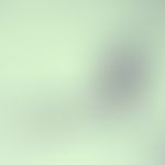 Filariasis. microfilaria of Brugia malayi. nuclei missing in the head area (anterior end). the li...