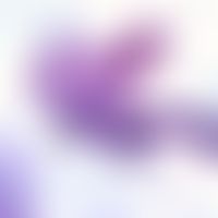 Filariose. Mikrofilarie von Wuchereria bancrofti. Das kernfreie Vorderende und die lange, promine...