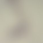 Filariasis. microfilaria of Wuchereria bancrofti. the seedless anterior end and the long, promine...