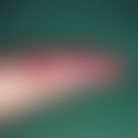 Fistel, arteriovenöse. Dermatosklerose und netzartige Weitstellung der Hautgefäße als Folge einer...
