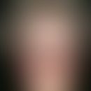 Flushphänomene. Plötzliches Gesichtserythem mit Hitzewallung und prickelndem Juckreiz der Gesicht...