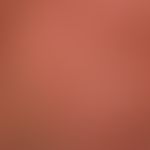 Folliculitis barbae: Massive purulent (ostio-)folliculitis after application of a tyrosine kinase...
