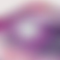 Foreign body granuloma; plant spine that has penetrated the skin with a giant cell inflammation o...