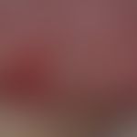 Gingivostomatitis, chronic. chronic dynamic, variable, 1.4 cm large, dolent, bizarrely configured...