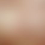 Graft-versus-Host-Disease, chronic. detail view: poikilodermatic picture with extensive whitish i...