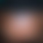 Granuloma, actinic
