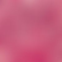 Granuloma anulare. in the lower third of the picture degenerated collagen with numerous nuclear f...