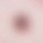Granuloma pyogenicum (pyogenic granuloma) Rapidly growing, bluish-black, soft, slightly bleeding ...