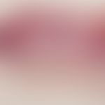 Granuloma pyogenicum (pyogenic granuloma) Tumour surrounded by an epithelial lip formation, centr...
