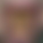 hairy tongue, black. brownish, yellowish-green or dirty greyish, sharply defined, warty, rough pl...