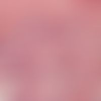 Hämangiom, kapilläres. Detailvergrößerung: Kapilläre Strukturen.