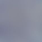 Immunohistological imaging of the endothelia (CD31) reveals the dense, "deer antler-like networke...