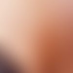 Neck fistula and cyst, lateral fistula opening with voiding at the anterior border of the sternoc...