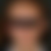 Parry-Romberg-Syndrom:&nbsp;Abb. 1 Ausgangsdokumentation der halbseitigen Gesichtsatrophie.
