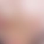 Herpes simplex virus infection (massive bacerial secondary infection) Large-scale herpes simplex ...