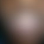 Herpes simplex virus infection: severe and extensive, multifocal herpes simplex infection of the ...