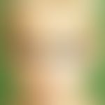 Hidroa vacciniformia: Large blisters and crusts in the area of the face in an 8-year-old boy afte...