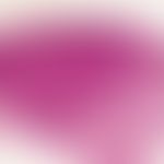 Dermatofibrom. Exophytischer Tumor der nahzu die gesamte Dermis ausfüllt. Epidermis an den aufste...