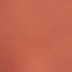Hyperpigmentation, caloric by regular warming at a heating stove. detailed view.
