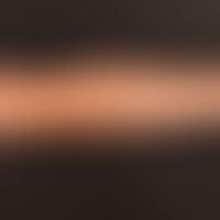 Hypertrichose. Seit dem 6. Lebensjahr zunehmende Körperbehaarung. Hier dargestellt ist der Befund...