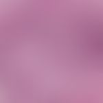 dermatoliposclerosis. enlargement of the vascular globules. wall thickened capillaries, surroundi...