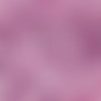 dermatoliposclerosis. enlargement of the vascular globules. wall thickened capillaries, surroundi...