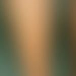 Hypomelanosis guttata idiopathica. Disseminierte, kleinfleckige Depigmentierungen im Bereich der ...