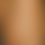 Ichthyosis congenita. Detailaufnahme des Oberschenkels: In groben Falten aufgeworfene, extrem tro...