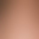 Ichthyosis follicularis. Dicht stehende, follikuläre, bräunliche Hornkegel die der Haut einen "re...