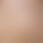 Ichthyosis vulgaris, autosomal-dominante. Detailausschnitt: Mulitple, bräunlich-gelbliche, nur we...